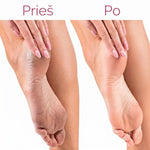 SilkStep™ elektrinis pėdų šveitiklis